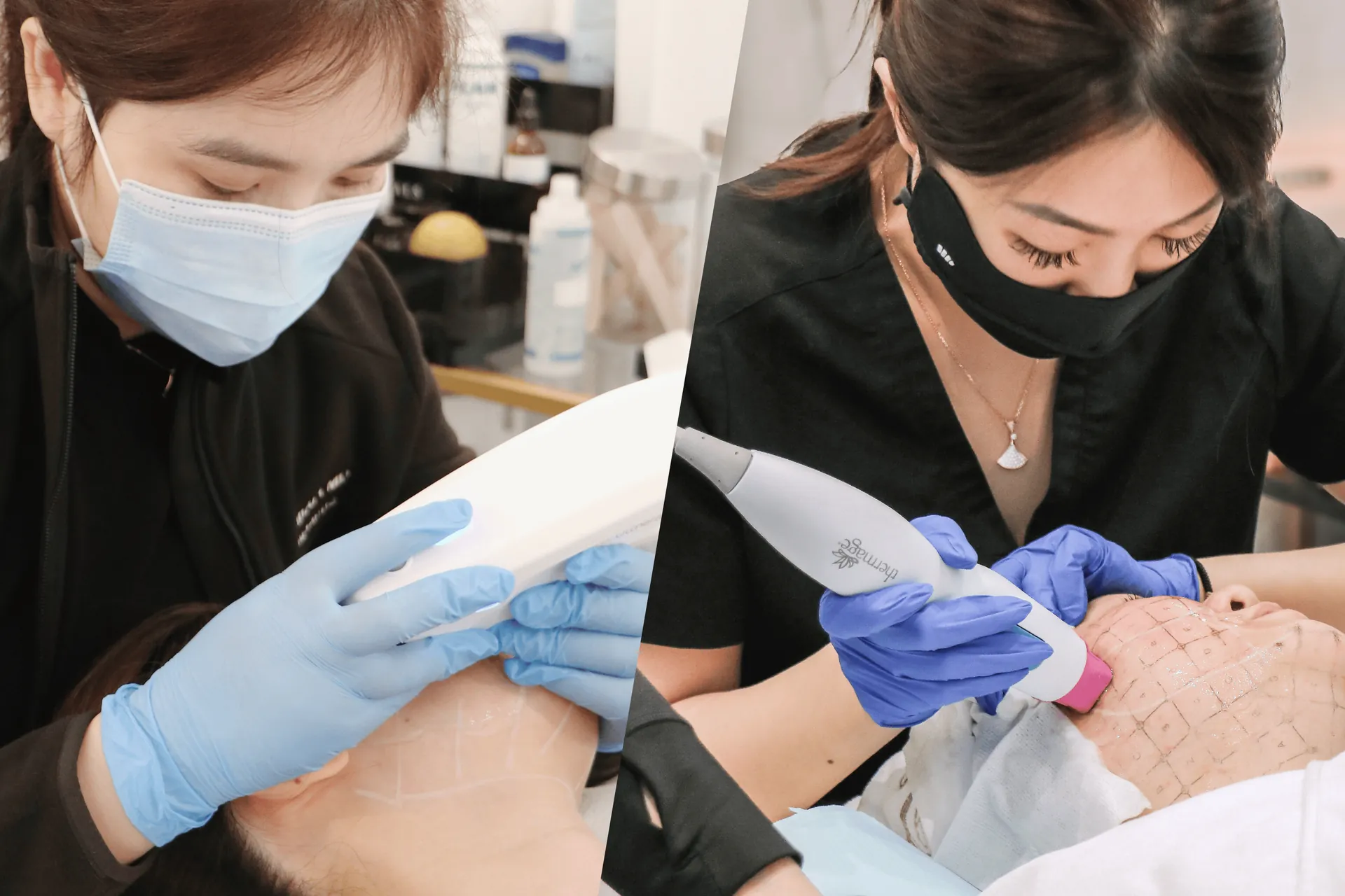 Ultherapy vs. Thermage: Which Non-Invasive Skin Lifting Treatment Wins in 2026?